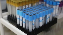  Проверяться на гепатит C нужно ежегодно — минздрав Ставрополья  